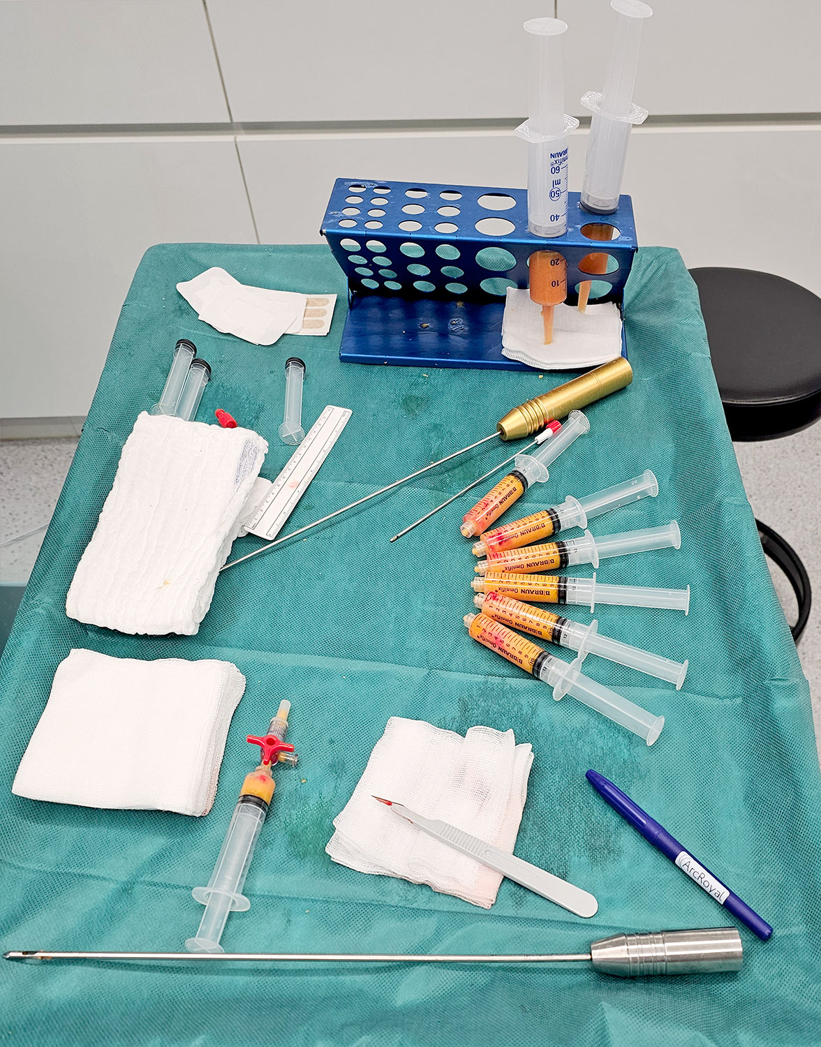 Body Contouring mit Eigenfett